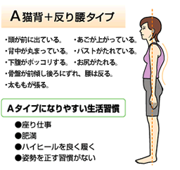【安城・豊田市・岡崎市・刈谷市・知立市整体】姿勢分析で猫背矯正
