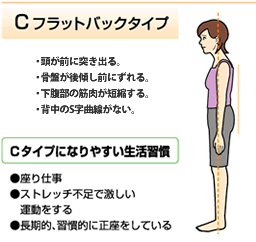 【豊田市・岡崎市・刈谷市整体】ストレートネックになっていませんか。